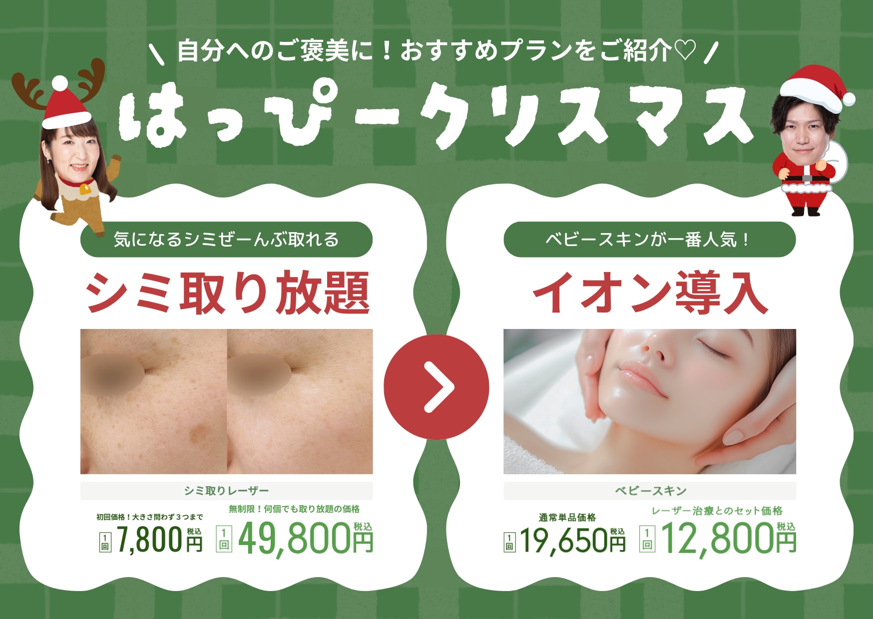 SBC新潟院スタッフが選ぶ❗️クリスマス・自分へのご褒美プラン2025 🎄✨